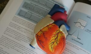 LVAD